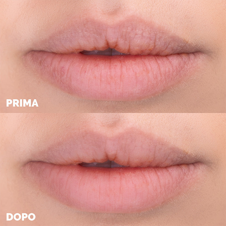 SUPRIMER LABBRA E CONTORNO OCCHI