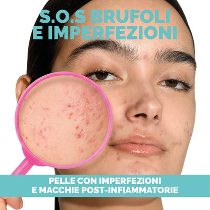 KIT S.O.S BRUFOLI & IMPERFEZIONI
