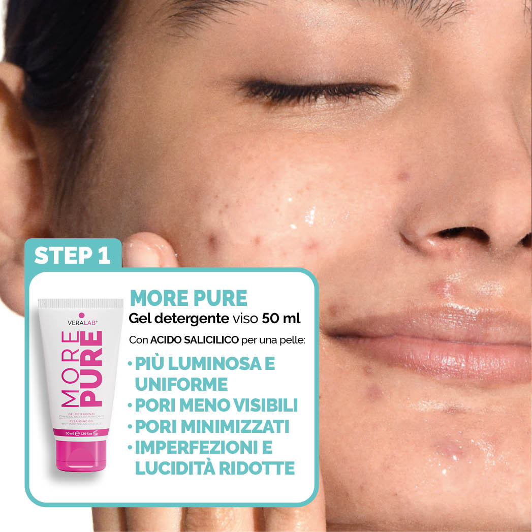 KIT S.O.S BRUFOLI & IMPERFEZIONI