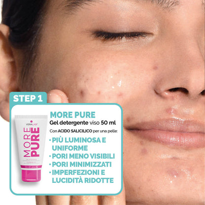 KIT S.O.S BRUFOLI & IMPERFEZIONI