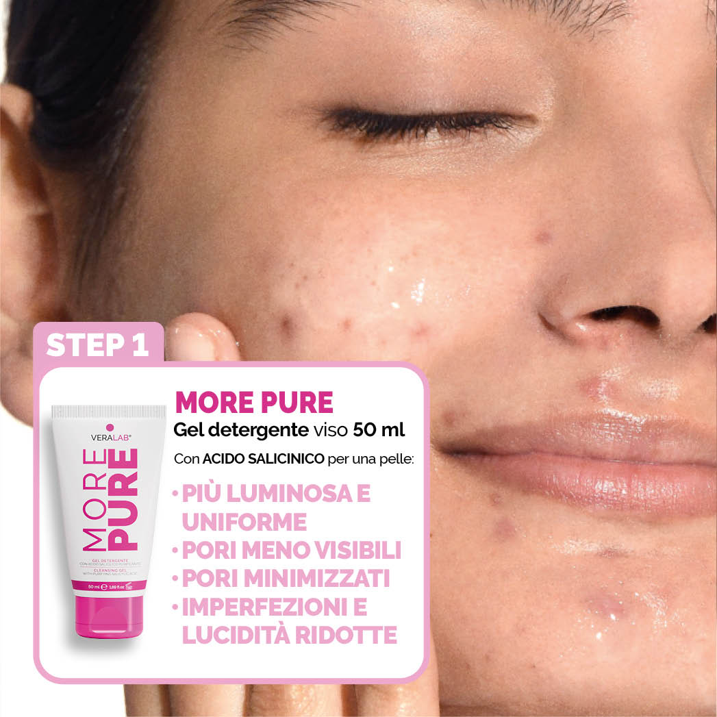 KIT S.O.S PELLE IMPURA