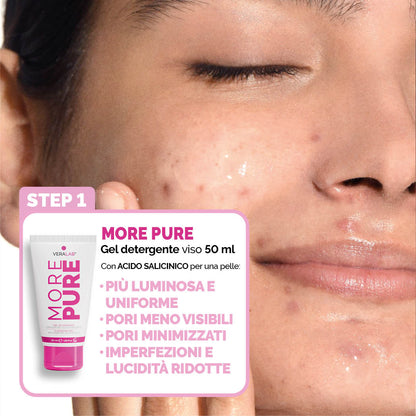 KIT S.O.S PELLE IMPURA