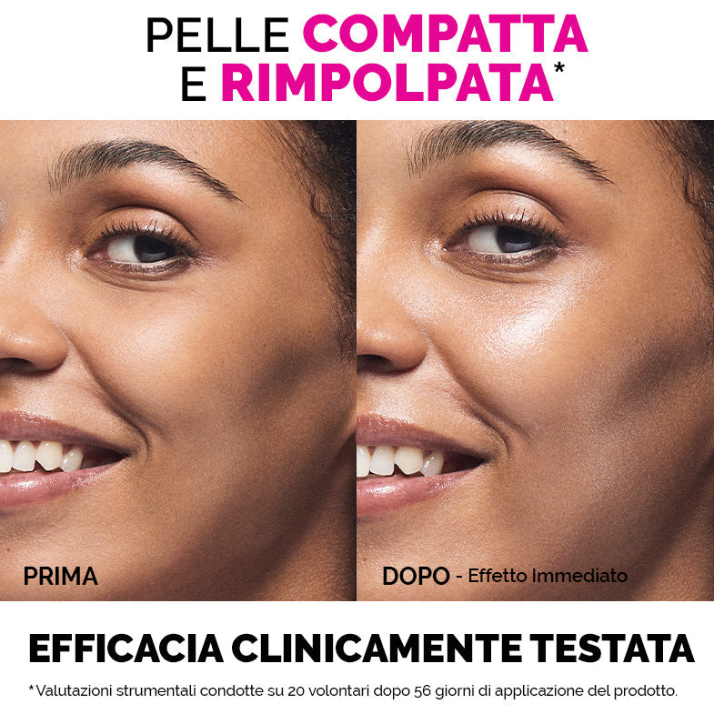 UPLIFT SIERO VISO